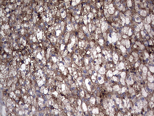 TG Antibody in Immunohistochemistry (Paraffin) (IHC (P))