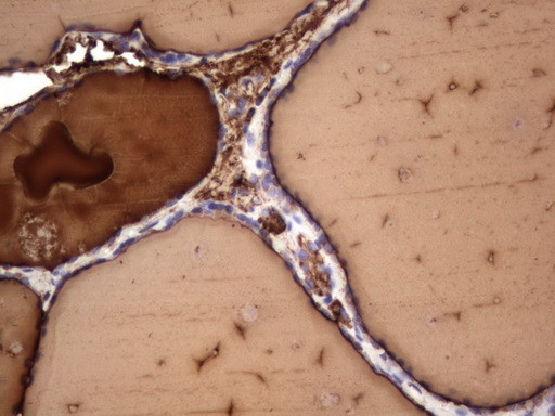 TG Antibody in Immunohistochemistry (Paraffin) (IHC (P))