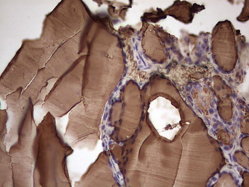 TG Antibody in Immunohistochemistry (Paraffin) (IHC (P))