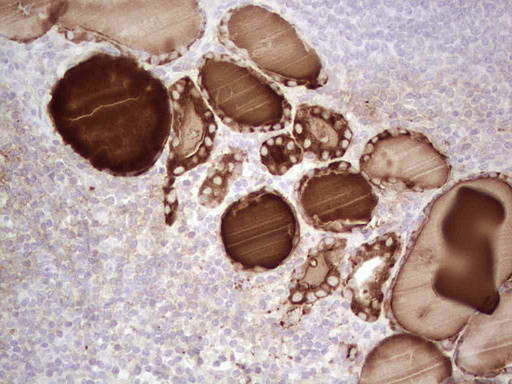 TG Antibody in Immunohistochemistry (Paraffin) (IHC (P))
