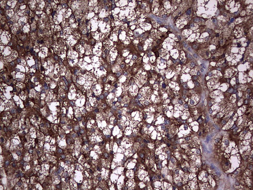 TG Antibody in Immunohistochemistry (Paraffin) (IHC (P))