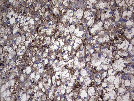 TG Antibody in Immunohistochemistry (Paraffin) (IHC (P))