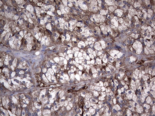 TG Antibody in Immunohistochemistry (Paraffin) (IHC (P))