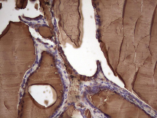 TG Antibody in Immunohistochemistry (Paraffin) (IHC (P))