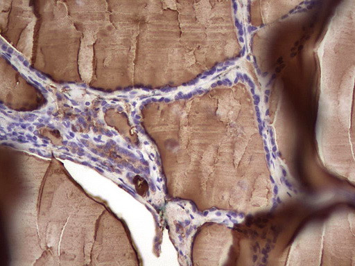TG Antibody in Immunohistochemistry (Paraffin) (IHC (P))
