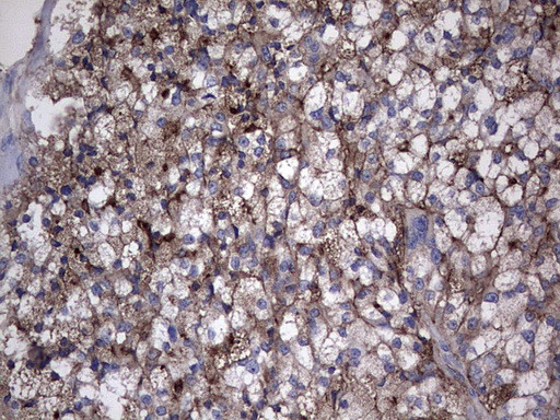 TG Antibody in Immunohistochemistry (Paraffin) (IHC (P))