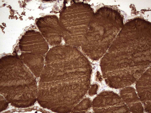 TG Antibody in Immunohistochemistry (Paraffin) (IHC (P))
