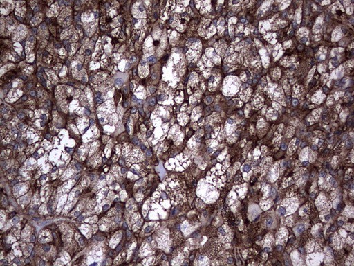 TG Antibody in Immunohistochemistry (Paraffin) (IHC (P))
