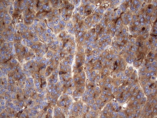 TG Antibody in Immunohistochemistry (Paraffin) (IHC (P))