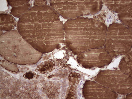 TG Antibody in Immunohistochemistry (Paraffin) (IHC (P))