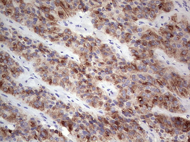 TG Antibody in Immunohistochemistry (Paraffin) (IHC (P))