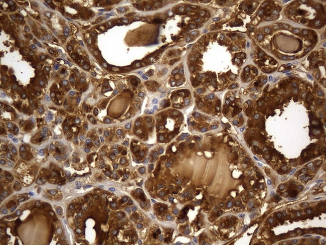 TG Antibody in Immunohistochemistry (Paraffin) (IHC (P))