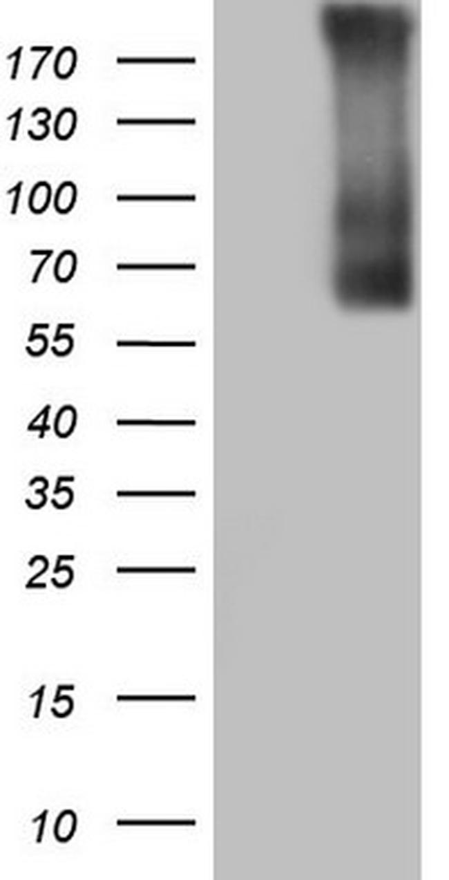 TG Antibody in Western Blot (WB)