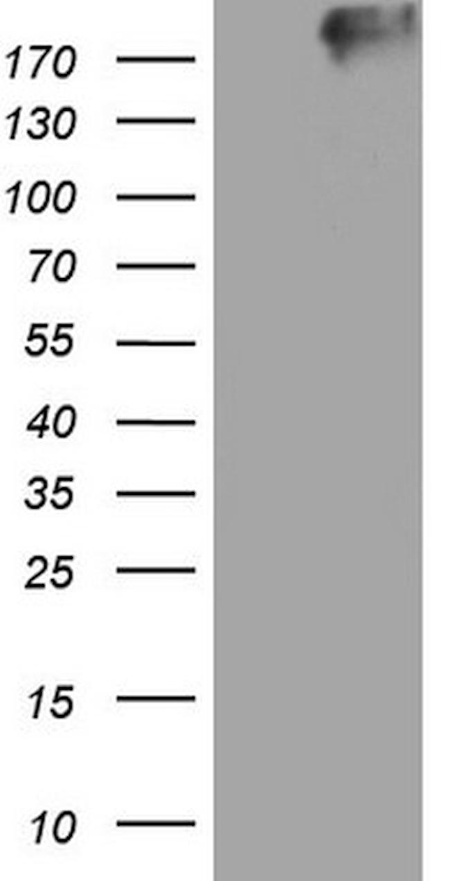 TG Antibody in Western Blot (WB)