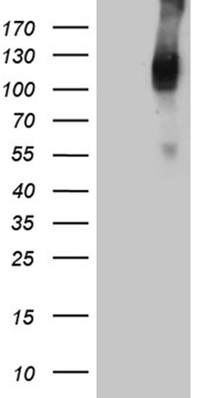 TGFBR3 Antibody in Western Blot (WB)