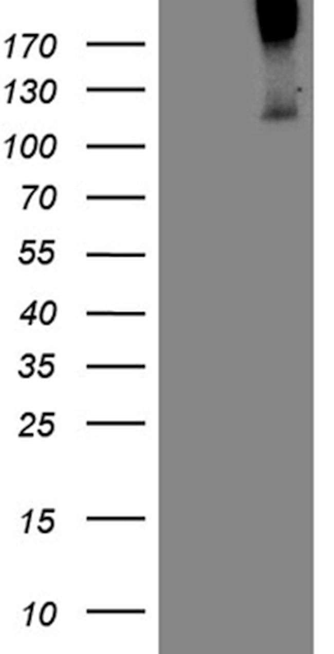 TGFBR3 Antibody in Western Blot (WB)