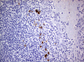 TGIF1 Antibody in Immunohistochemistry (Paraffin) (IHC (P))