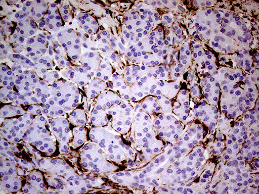 TGM2 Antibody in Immunohistochemistry (Paraffin) (IHC (P))