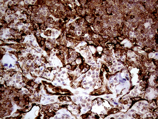 TGM2 Antibody in Immunohistochemistry (Paraffin) (IHC (P))
