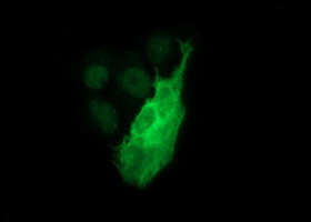 TH Antibody in Immunocytochemistry (ICC/IF)