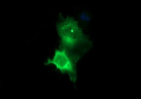 TH Antibody in Immunocytochemistry (ICC/IF)