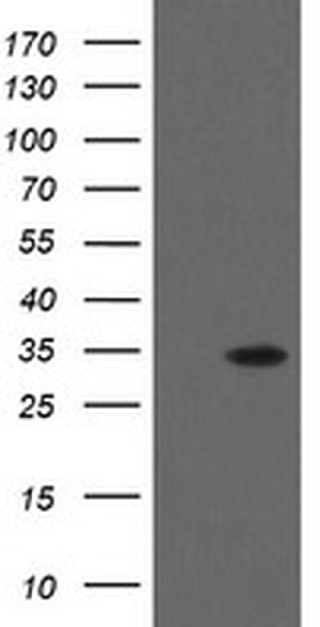 THAP6 Antibody in Western Blot (WB)