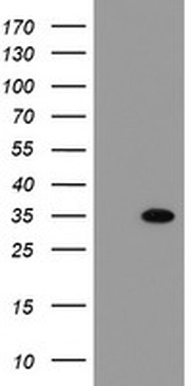 THAP6 Antibody in Western Blot (WB)