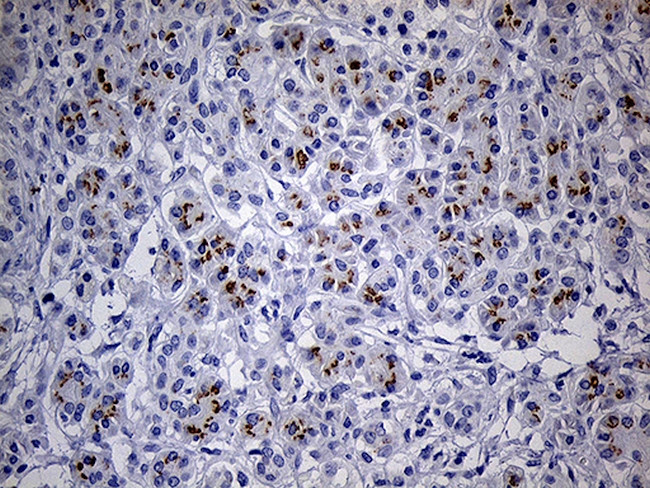 THAP8 Antibody in Immunohistochemistry (Paraffin) (IHC (P))
