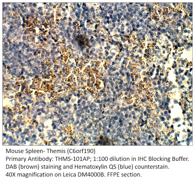 Themis Antibody in Immunohistochemistry (IHC)
