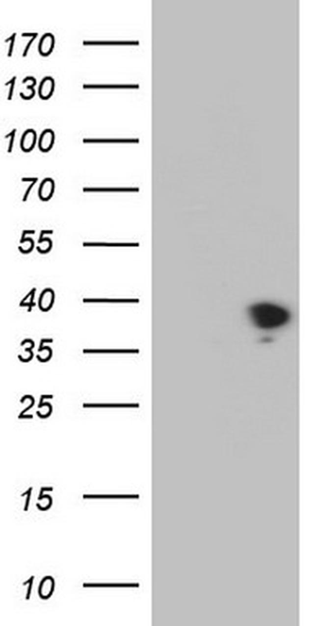 THTPA Antibody in Western Blot (WB)