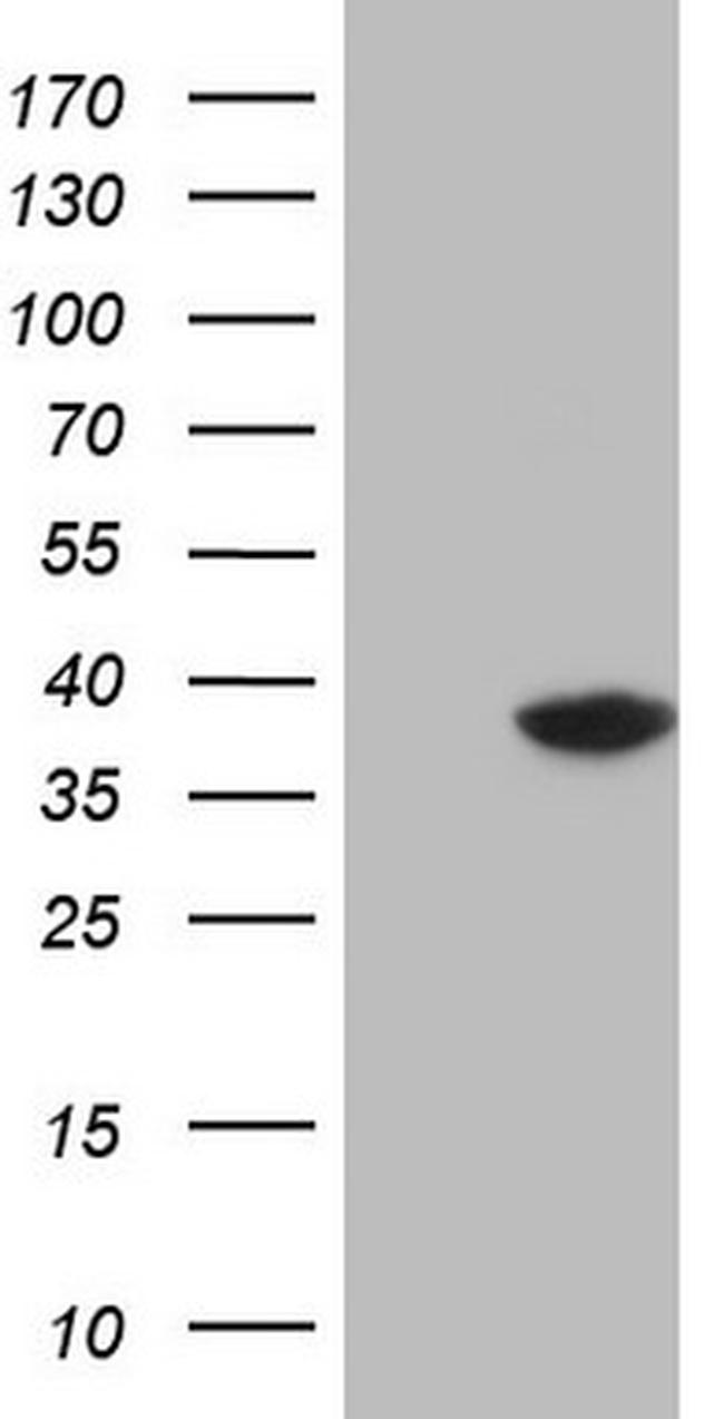THTPA Antibody in Western Blot (WB)
