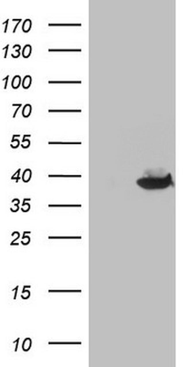 THTPA Antibody in Western Blot (WB)