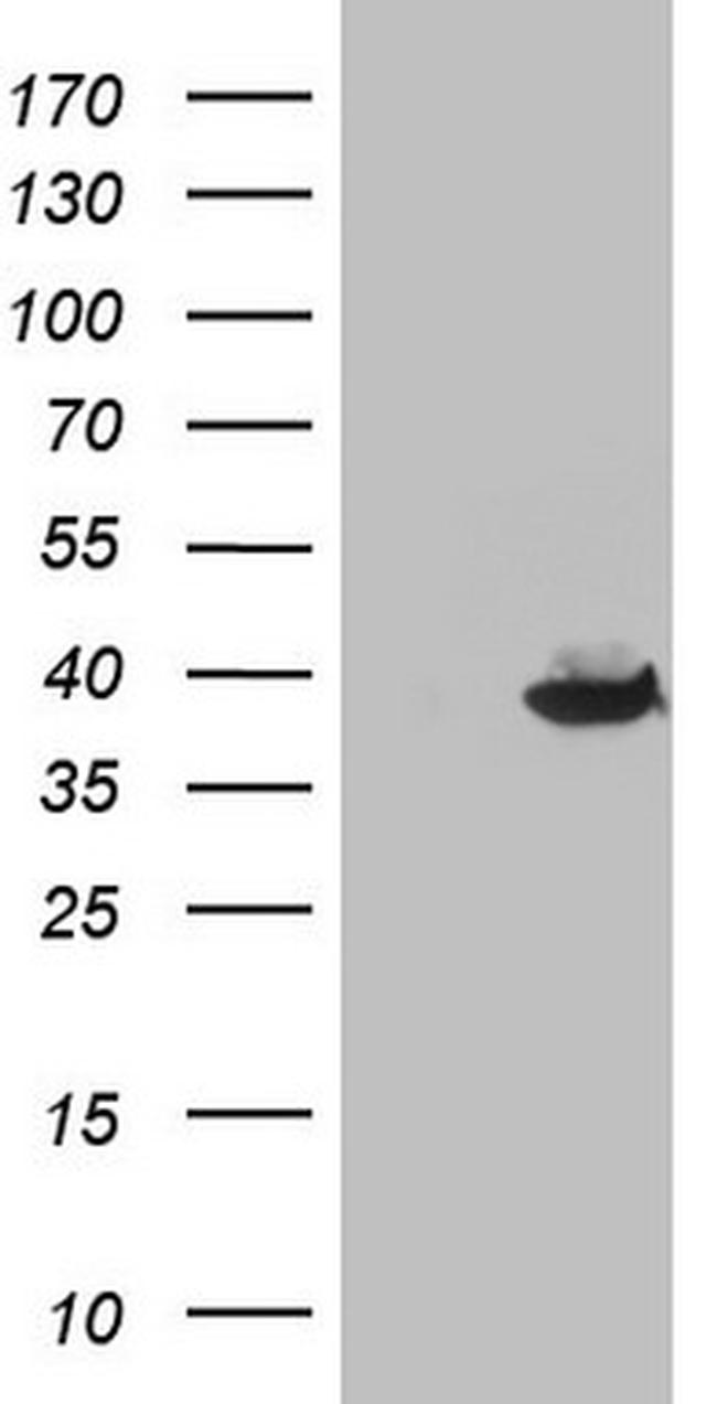 THTPA Antibody in Western Blot (WB)
