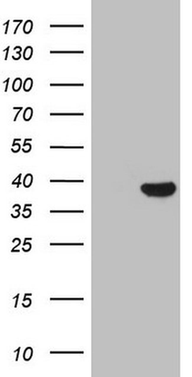 THTPA Antibody in Western Blot (WB)