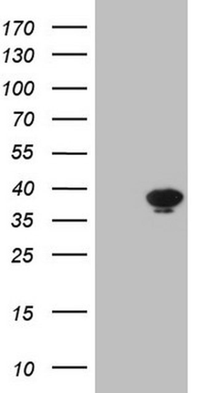 THTPA Antibody in Western Blot (WB)