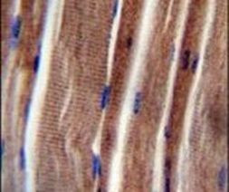 THUMPD3 Antibody in Immunohistochemistry (IHC)