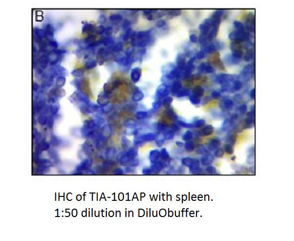 TIA1 Antibody in Immunohistochemistry (IHC)