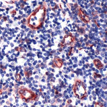 TIE1 Antibody in Immunohistochemistry (Paraffin) (IHC (P))
