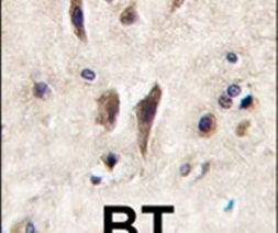 TIE1 Antibody in Immunohistochemistry (IHC)