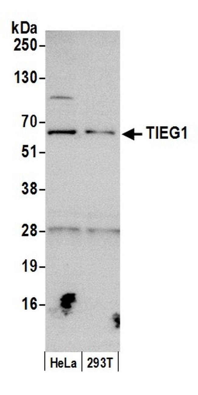 TIEG1 Antibody in Western Blot (WB)