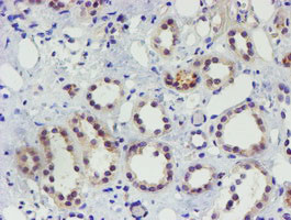 TIGD1 Antibody in Immunohistochemistry (Paraffin) (IHC (P))