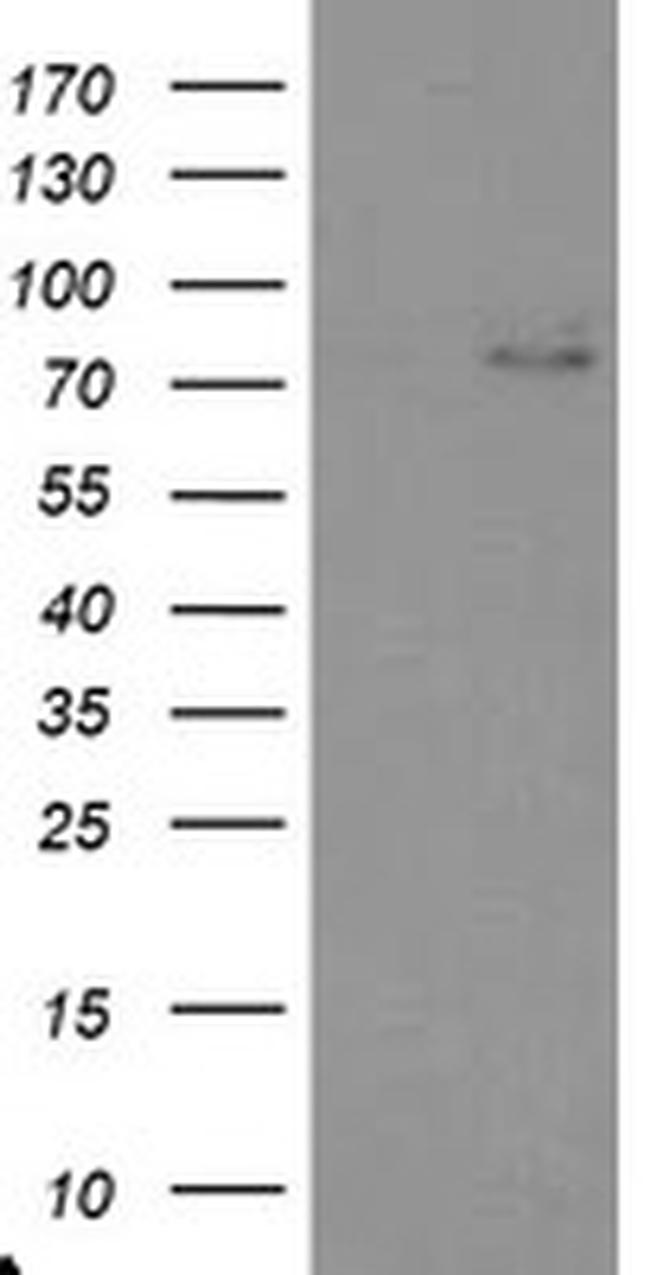 TIGD1 Antibody in Western Blot (WB)
