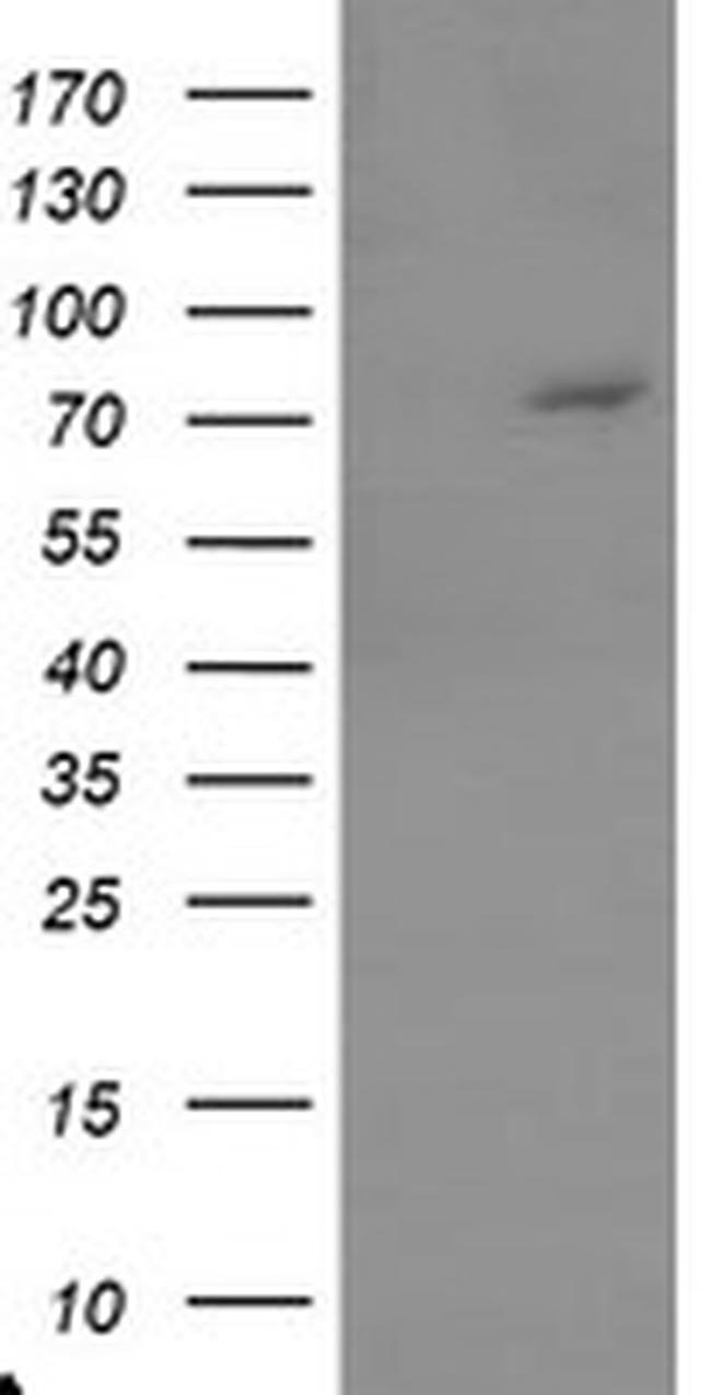 TIGD1 Antibody in Western Blot (WB)