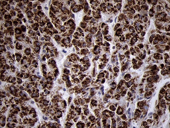 TIMM8A Antibody in Immunohistochemistry (Paraffin) (IHC (P))