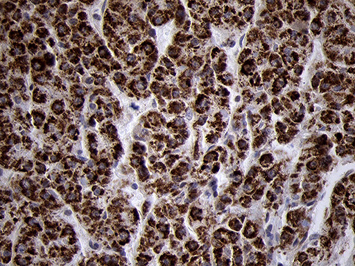TIMM8A Antibody in Immunohistochemistry (Paraffin) (IHC (P))