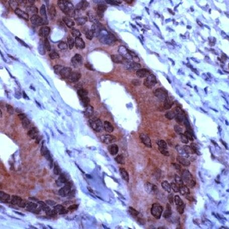 TIMP1 Antibody in Immunohistochemistry (IHC)
