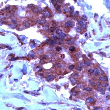 TIMP2 Antibody in Immunohistochemistry (IHC)
