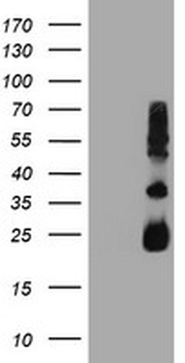 TIMP2 Antibody in Western Blot (WB)