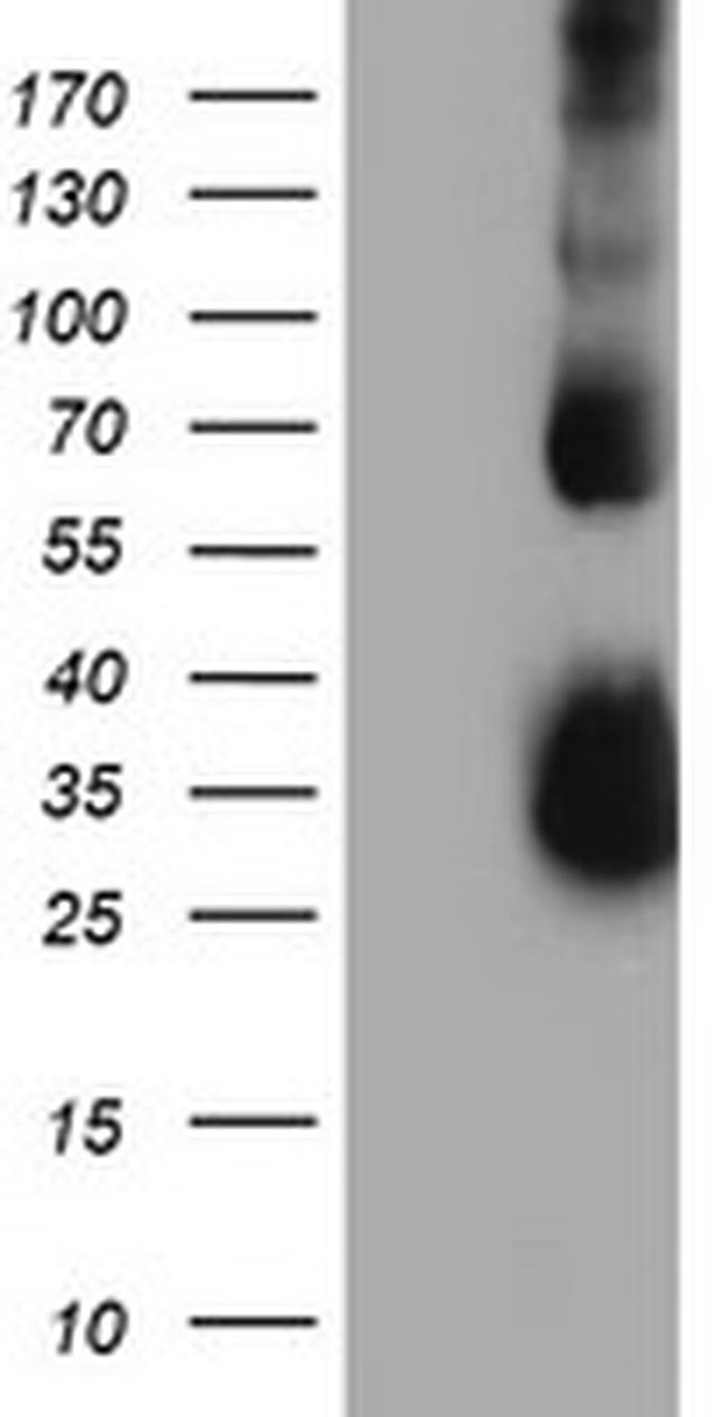 TIMP2 Antibody in Western Blot (WB)