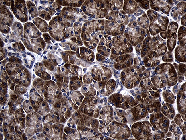 TINF2 Antibody in Immunohistochemistry (Paraffin) (IHC (P))